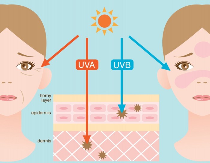 Alergia a la luz uv led